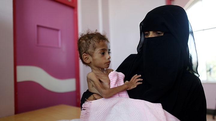 WFP Umumkan Bantuan ke Yaman Akan Berkurang karena Krisis Pendanaan